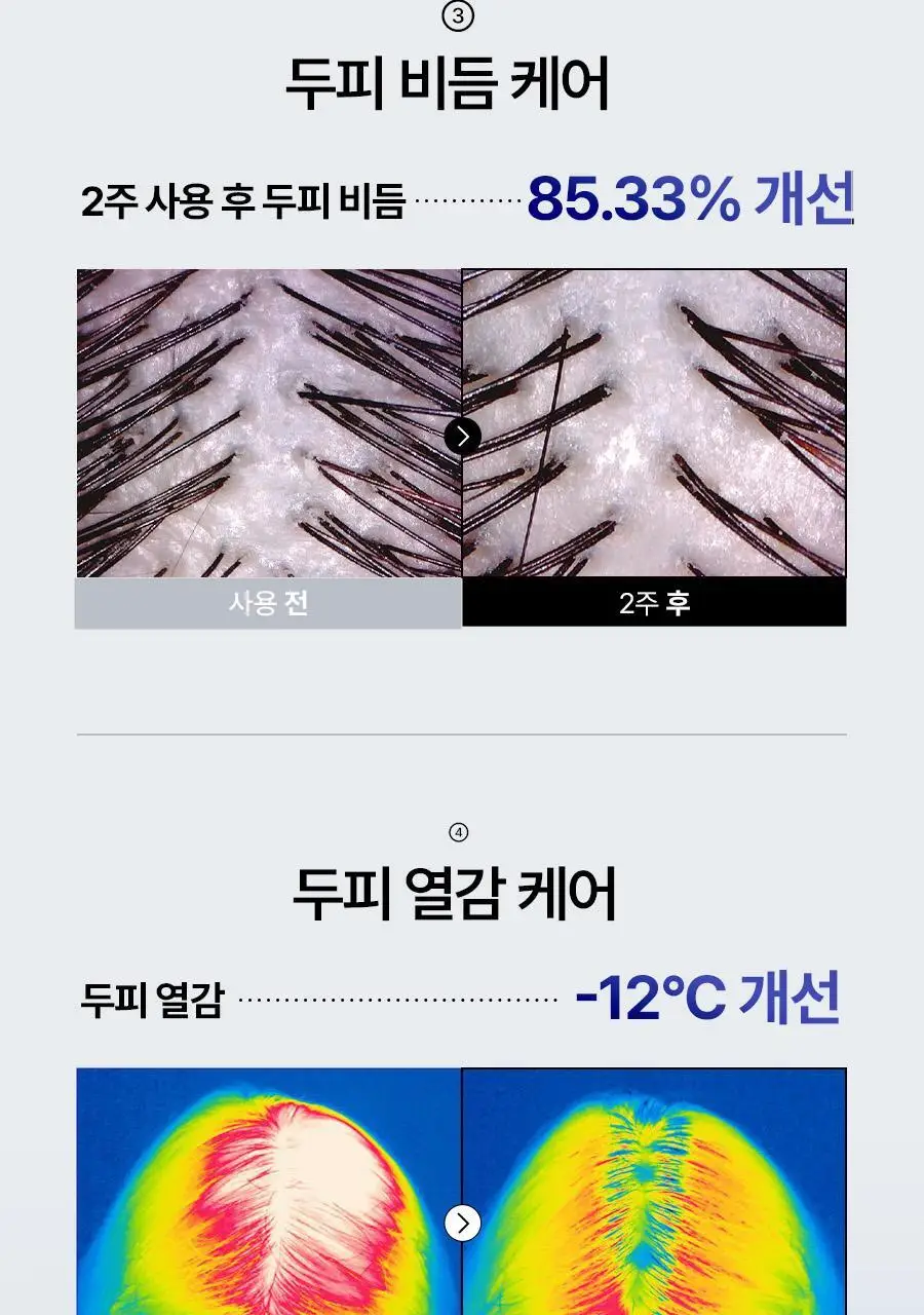 [2주완성탈모앰플] 에이페 스칼프부스팅 앰플 (대용량 두피앰플) 150ml 상세페이지 34